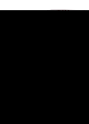 ALLIUM CEPA D 30 Dilution